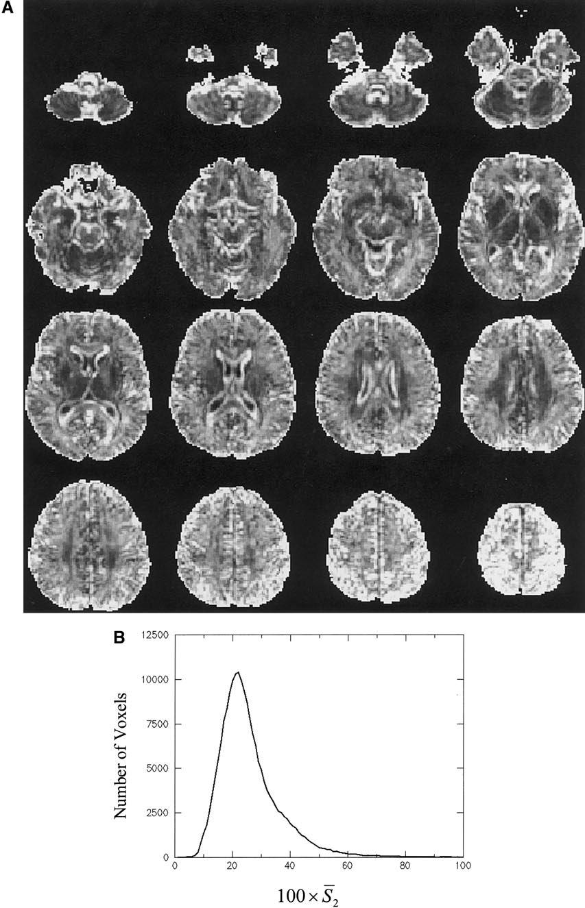 Spatial normalization and averaging of diffusion tensor {MRI} data sets