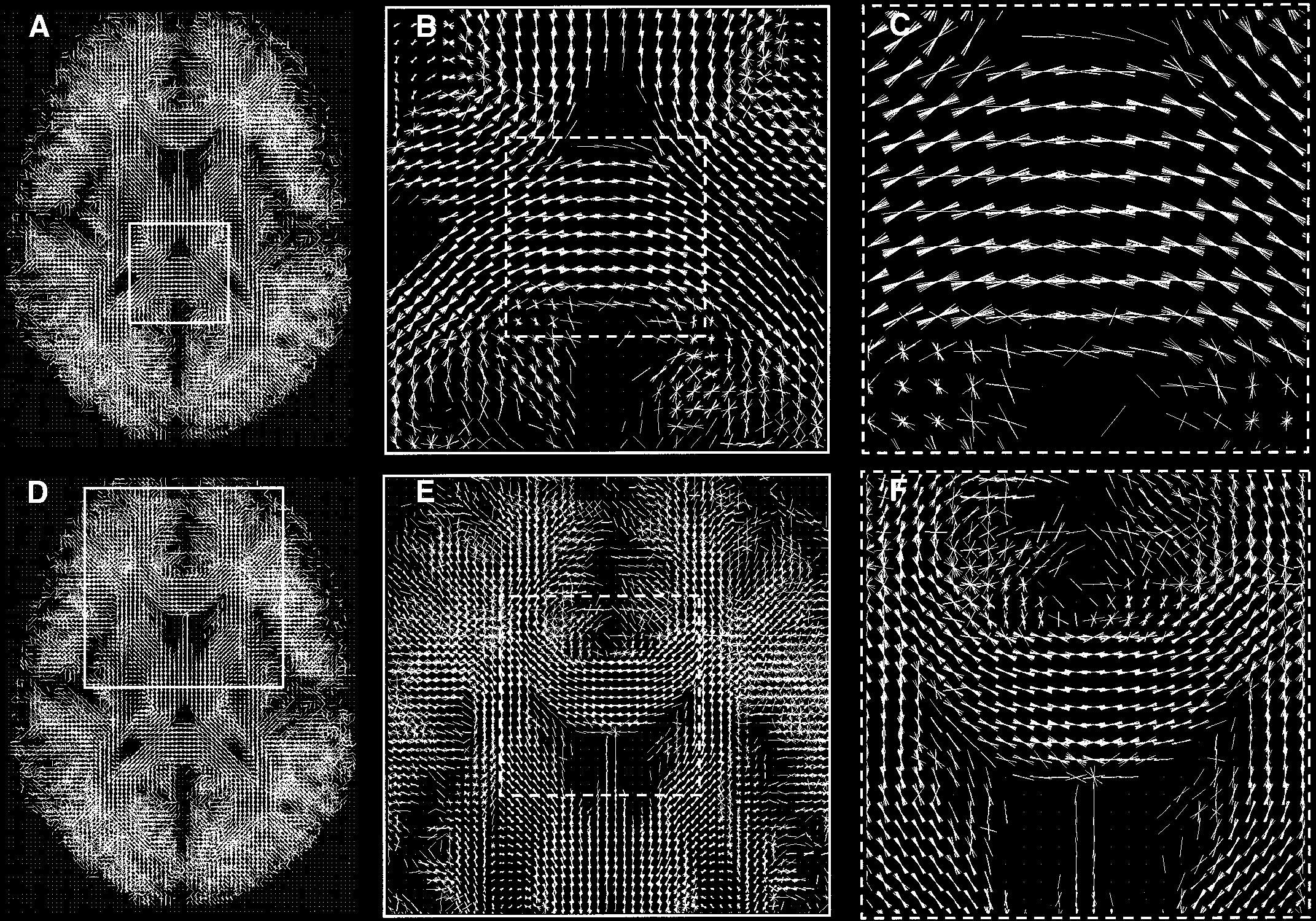 Spatial normalization and averaging of diffusion tensor {MRI} data sets