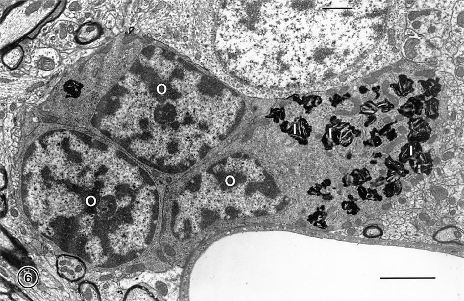 The effects of normal aging on myelin and nerve fibers: A review