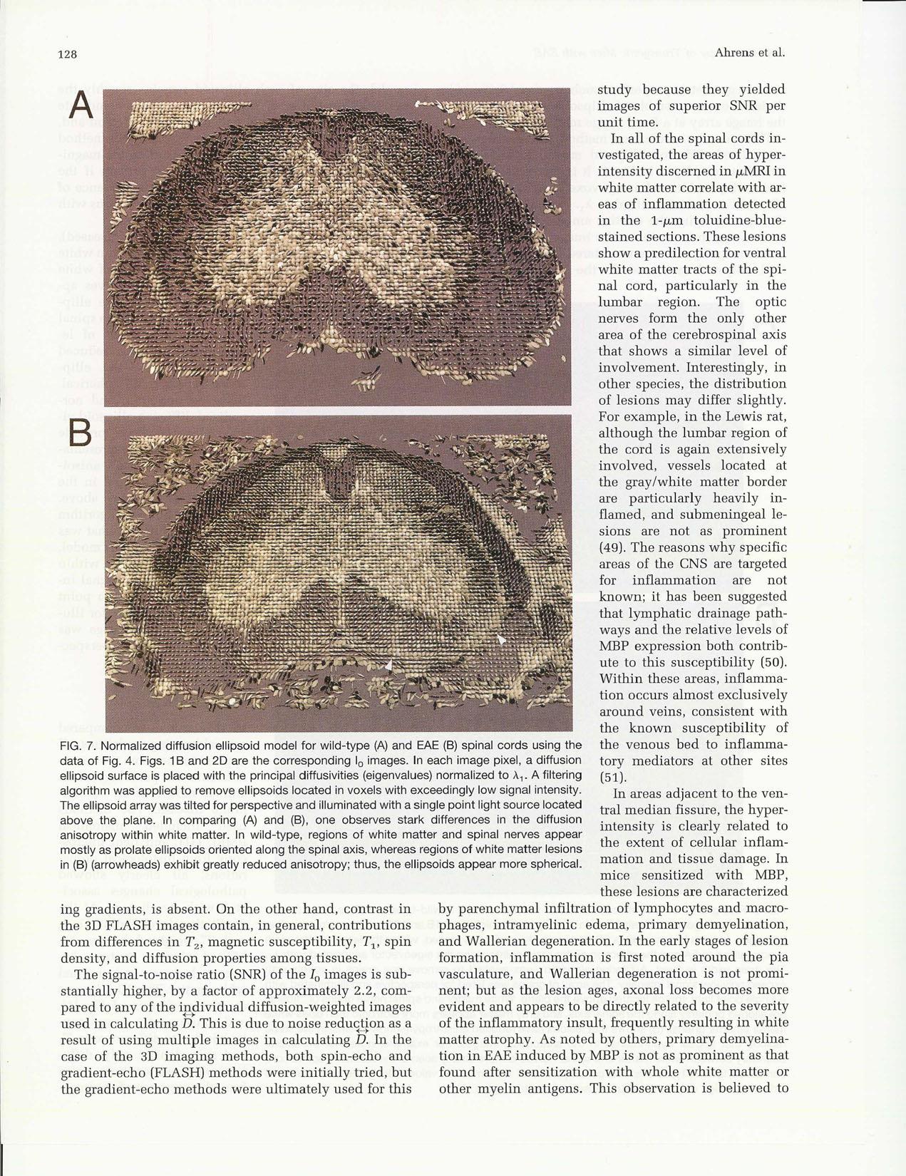 {MR} Microscopy of Transgenic Mice that Spontaneously Aquire Experimental Allergic Encephalomyelitis