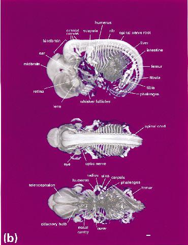 Towards a Micro{MRI} Atlas of Mouse Development