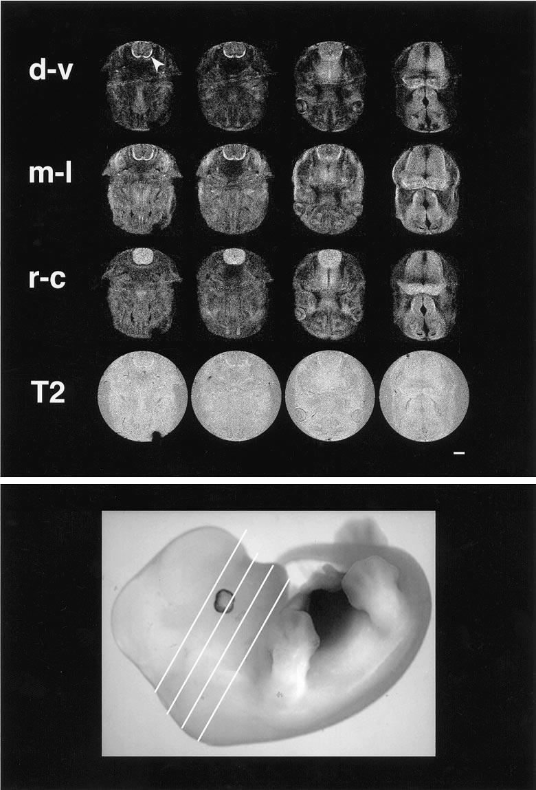 Towards a Micro{MRI} Atlas of Mouse Development