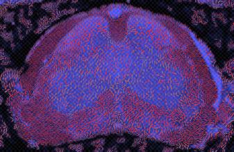 Visualizing Diffusion Tensor Images of the Mouse Spinal Cord