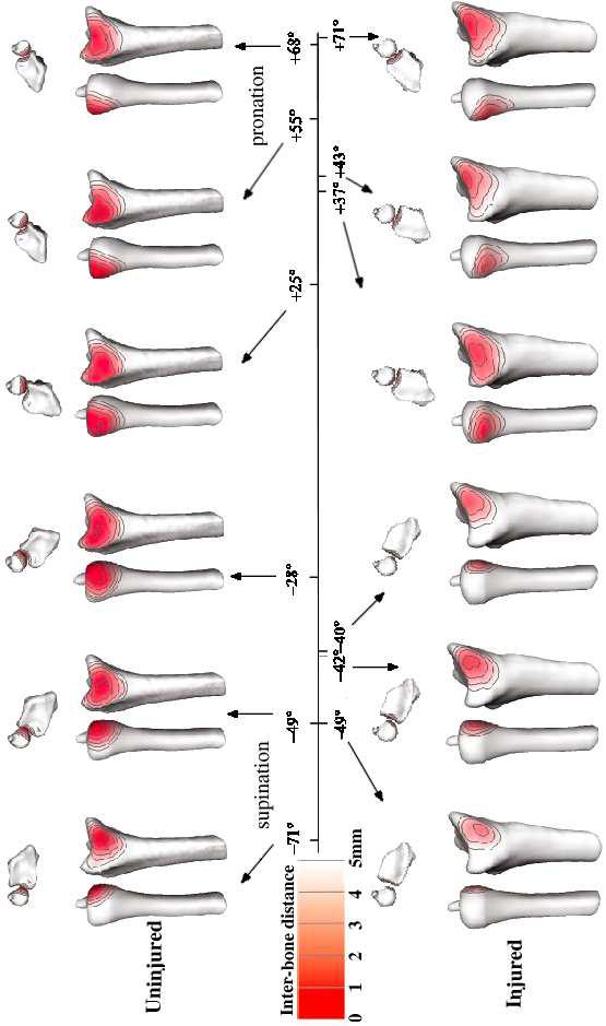 Estimating joint contact areas and ligament lengths from bone kinematics and surfaces
