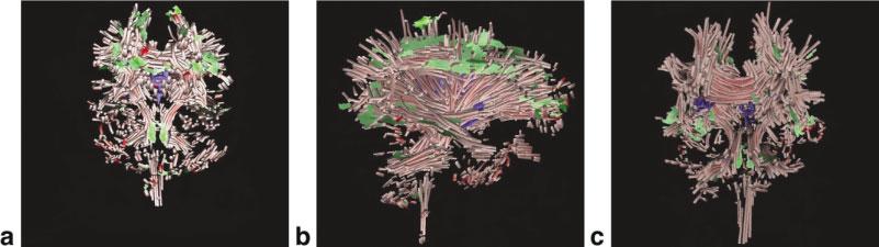 Visualization and Analysis of White Matter Structural Asymmetry in Diffusion Tensor {MR} Imaging Data