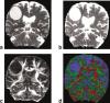 Visualization and Analysis of White Matter Structural Asymmetry in Diffusion Tensor {MR} Imaging Data